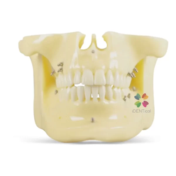 iDENTical Orthodontic Implant Model M2016