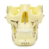 iDENTical Skull Education Model With Fracture And Restoration (M5004)